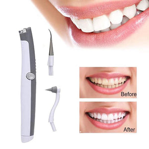 Electric Ultrasonic Tooth Stain Eraser