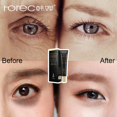 ROREC Hyaluronic Acid Anti Aging Against Puffiness Eye Serum